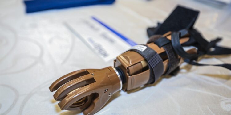 Cundinamarca transforma vidas con entrega gratuita de prótesis de miembro superior.